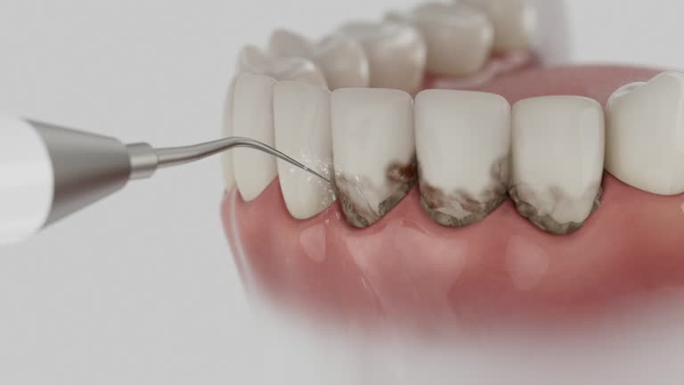 Reliable Dental Implants contractor in Topeka, IN by Smile Center Dentistry